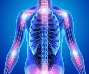 EL CÁNCER
